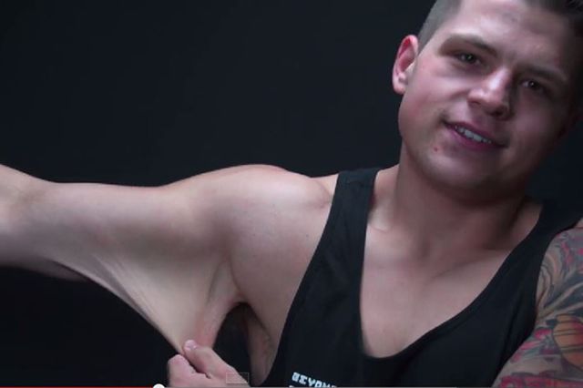 John David Glod dream of the perfect body and has lost 73 kg. But it seems that something went wrong...