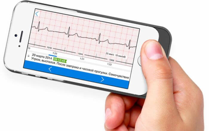 CardioQVARK mobile gadget to check your heart